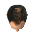 Hairline Image